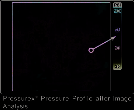 Pressurex Pressure Profile after Image Analysis